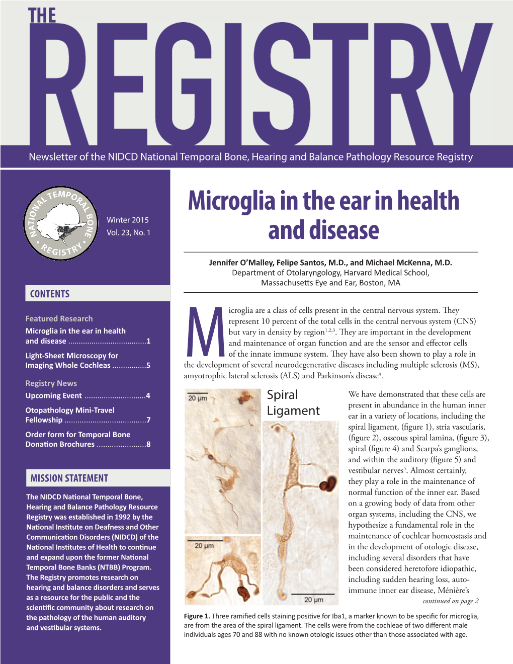 Microglia in the Ear in Health and Disease