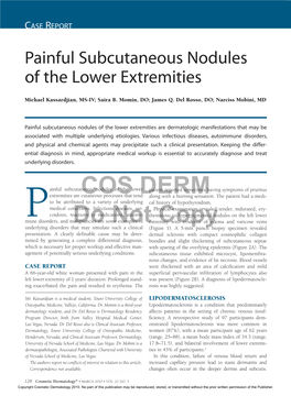 Painful Subcutaneous Nodules of the Lower Extremities