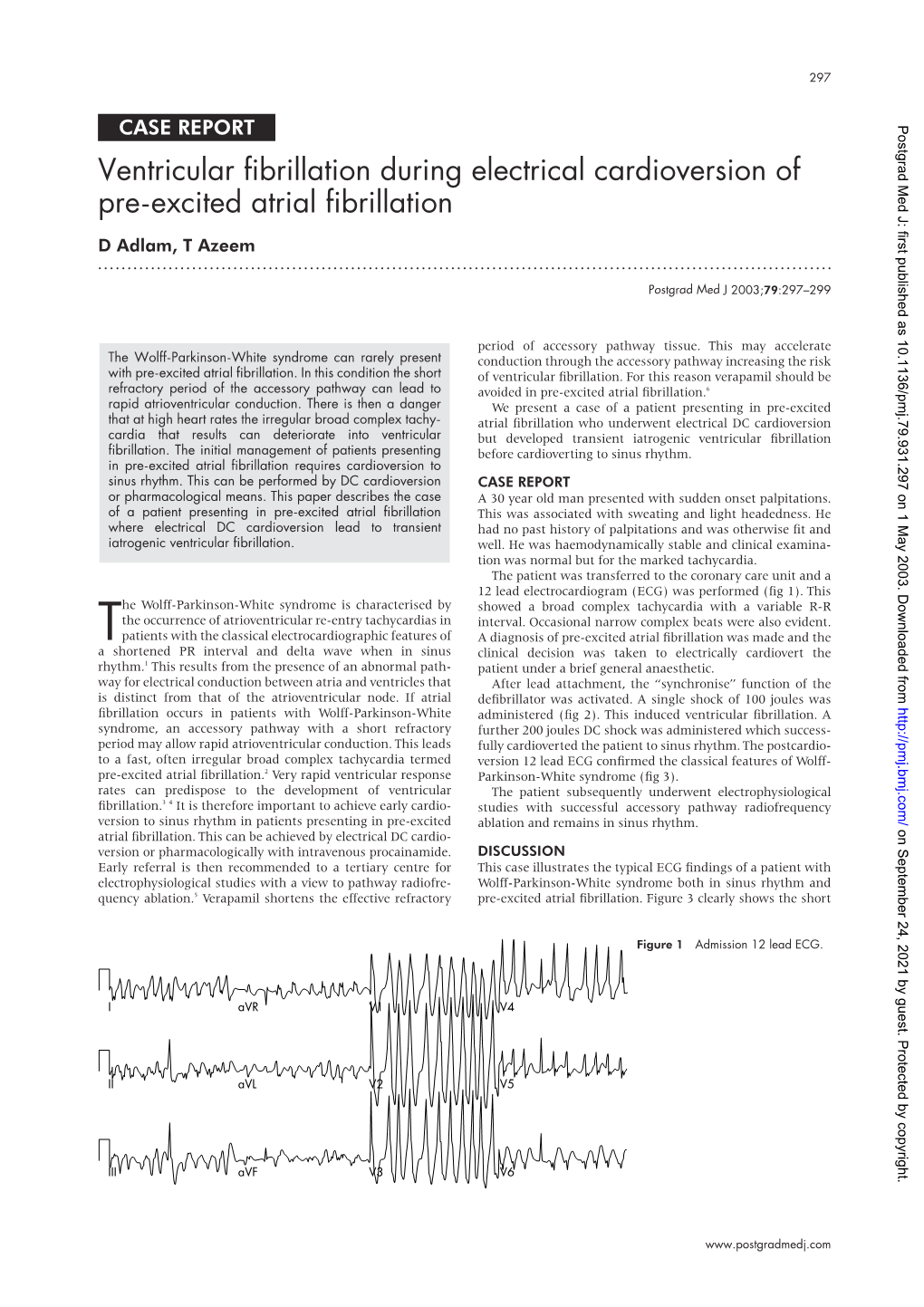 Ventricular Fibrillation During Electrical Cardioversion of Pre-Excited Atrial Fibrillation D Adlam, T Azeem