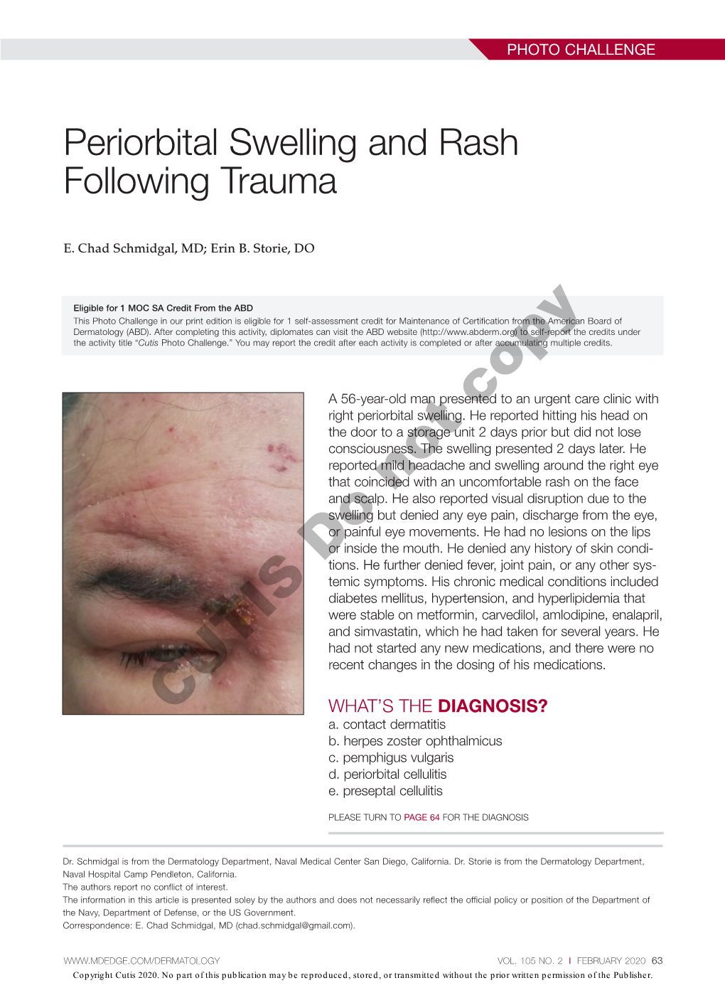 Periorbital Swelling and Rash Following Trauma