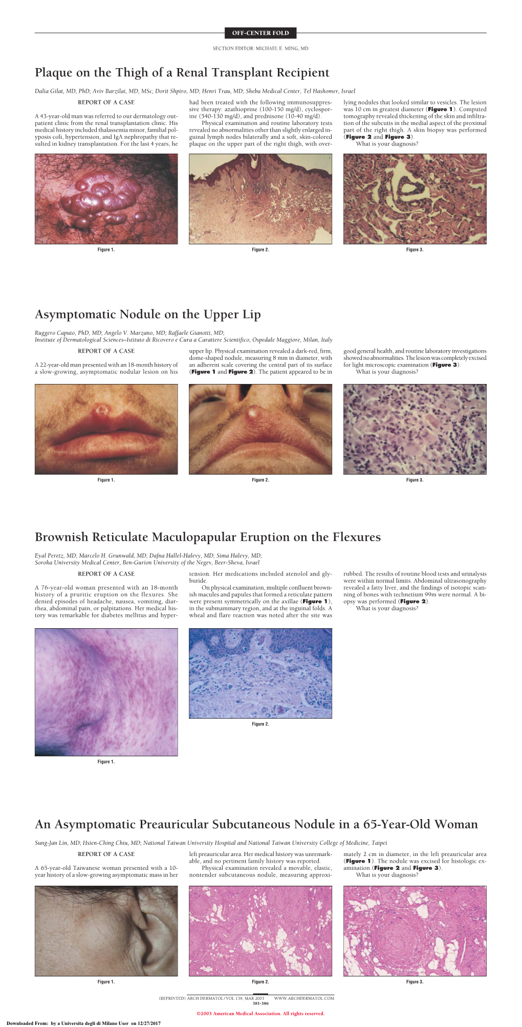 Asymptomatic Nodule on the Upper Lip Quiz Case
