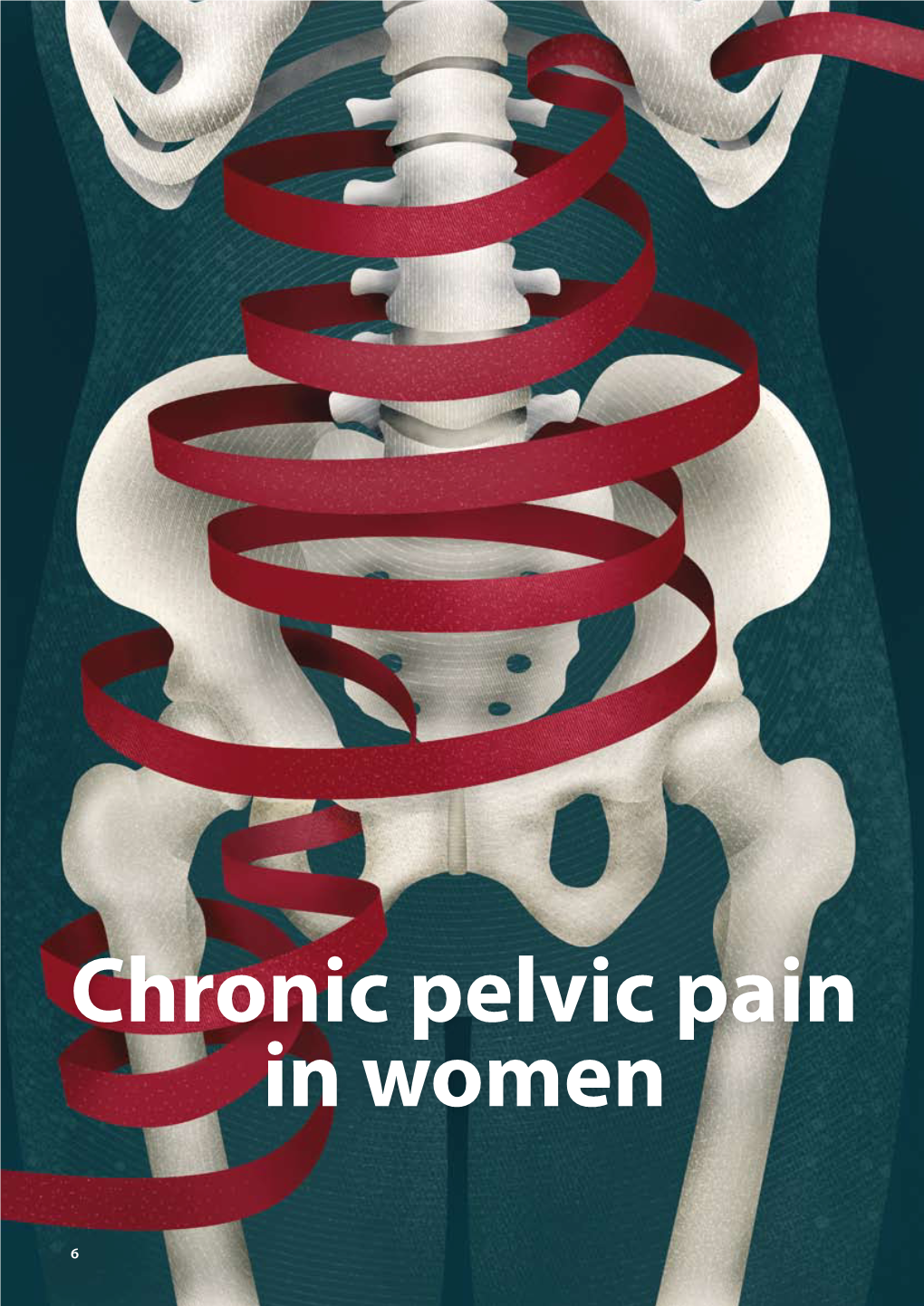 Chronic Pelvic Pain in Women