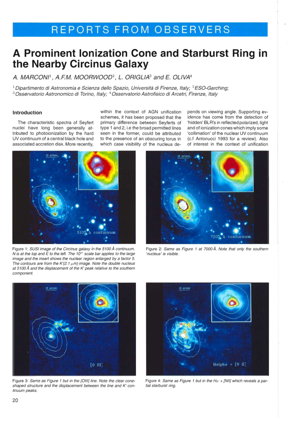 A Prominent Ionization Cone and Starburst Ring in the Nearby Circinus Galaxy