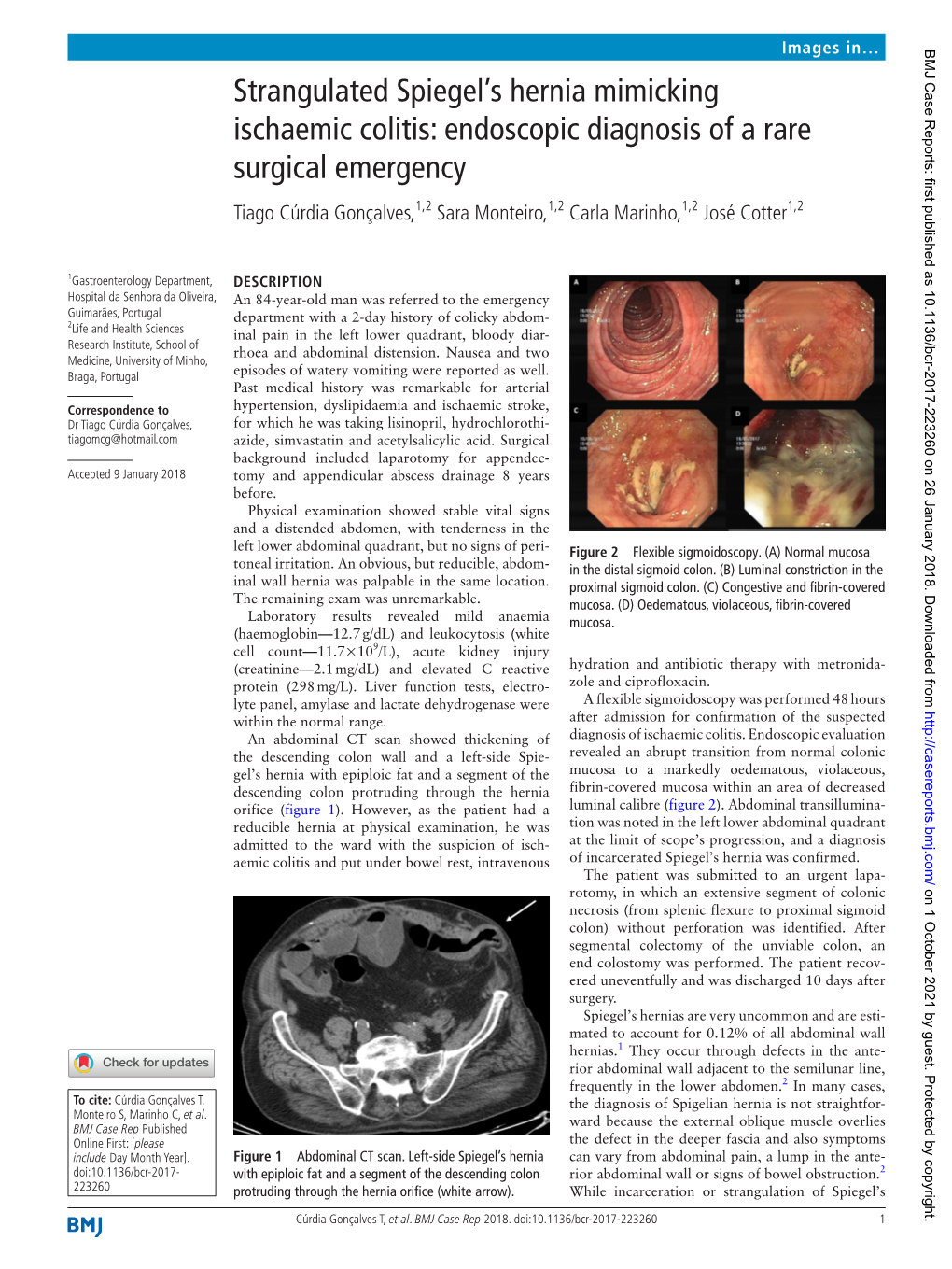 Strangulated Spiegel's Hernia Mimicking Ischaemic Colitis