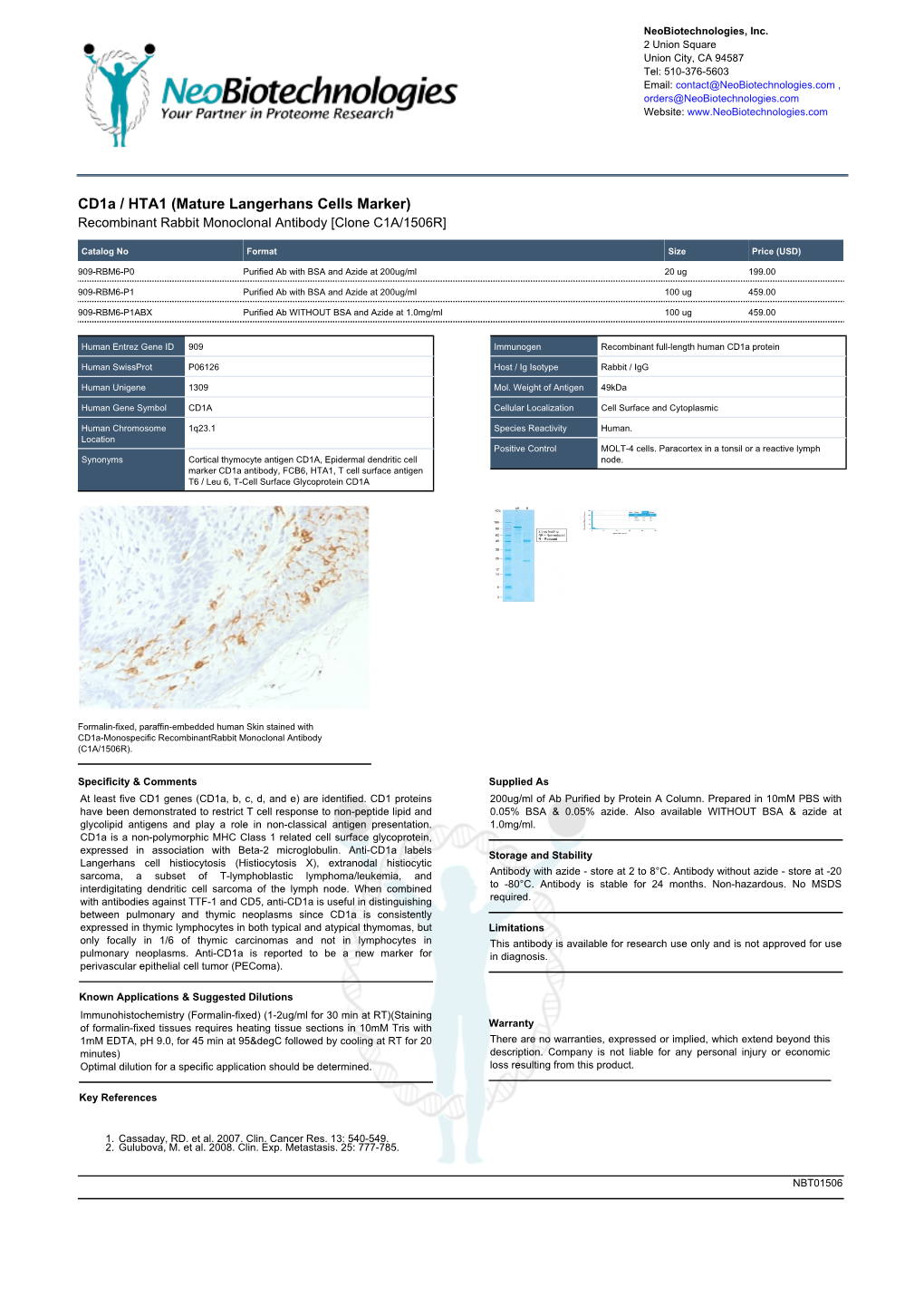 Cd1a / HTA1 (Mature Langerhans Cells Marker) Recombinant Rabbit Monoclonal Antibody [Clone C1A/1506R]