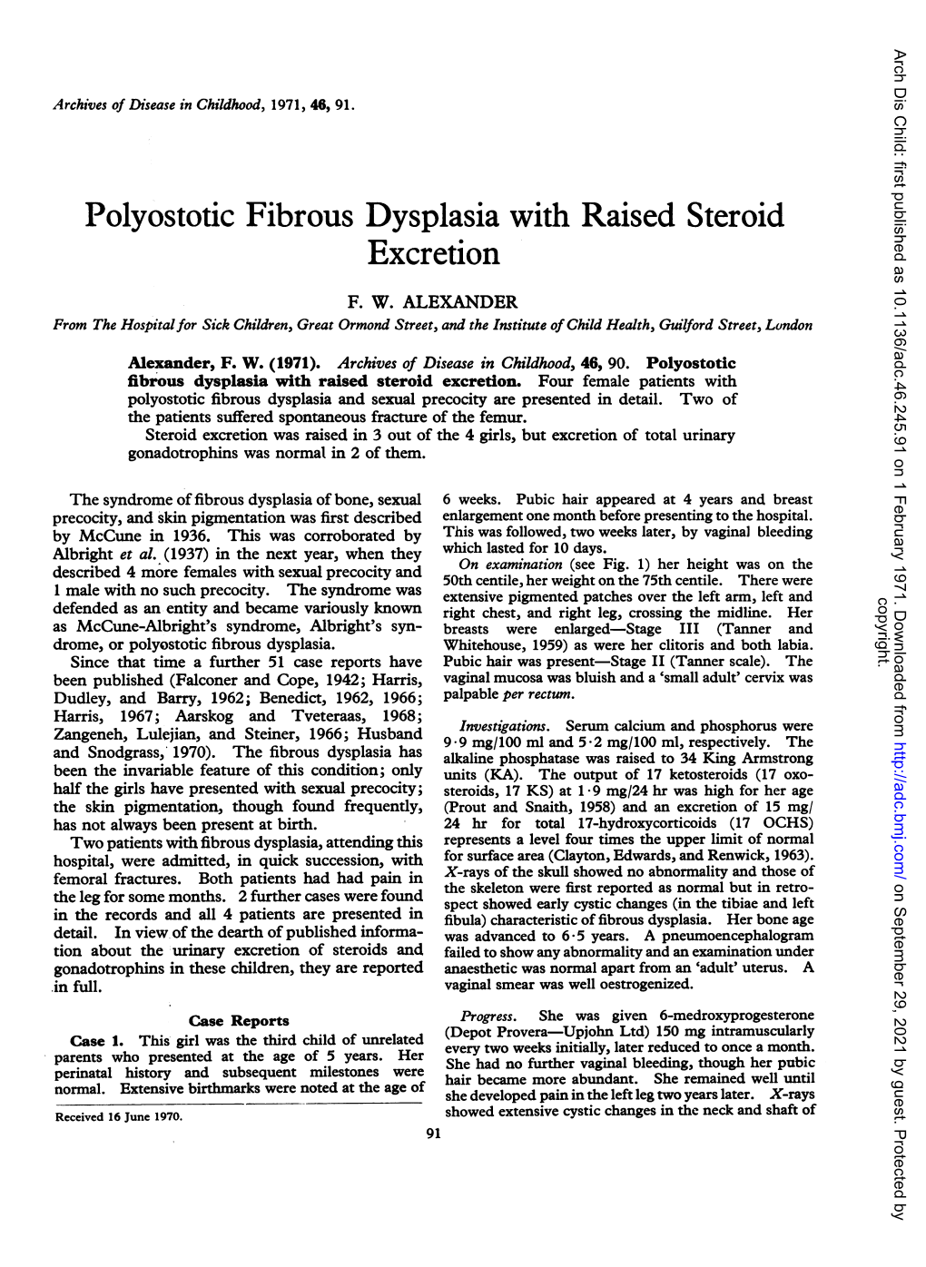 Polyostotic Fibrous Dysplasia with Raised Steroid Excretion