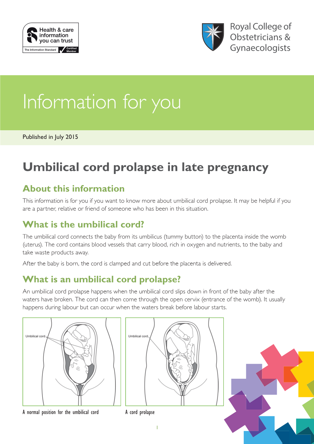 Cord Prolapse Prolapse in Inlate Late Pregnancypregnancypublished in July 2015