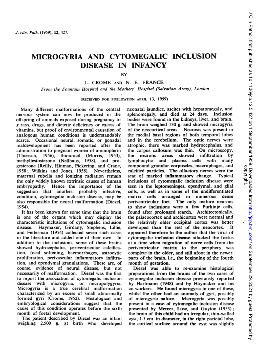 Microgyria and Cytomegalic Inclusion Disease in Infancy by L