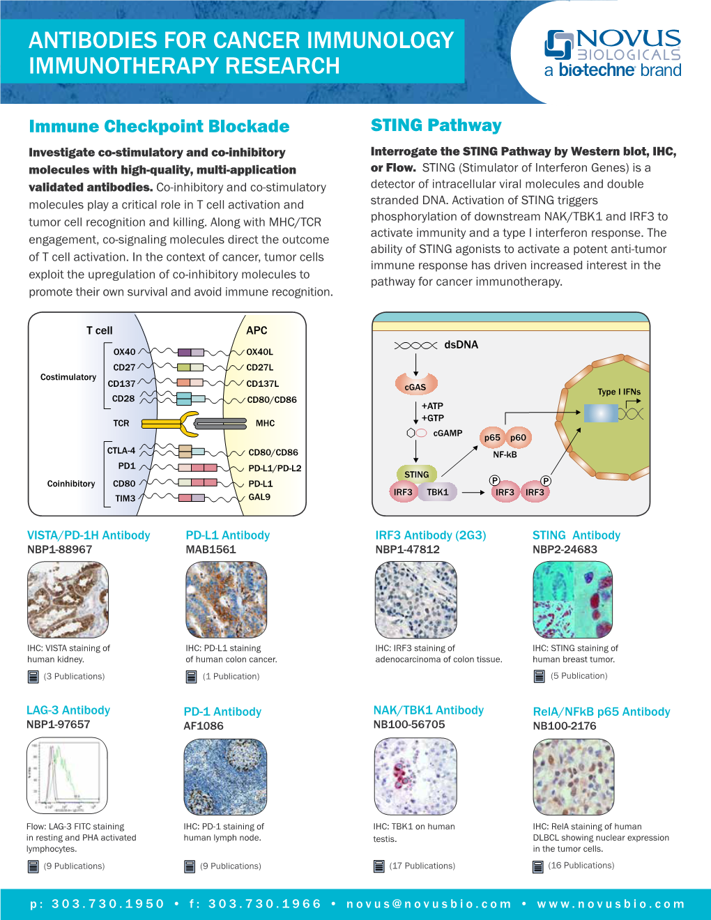 Antibodies for Cancer Immunology Immunotherapy Research