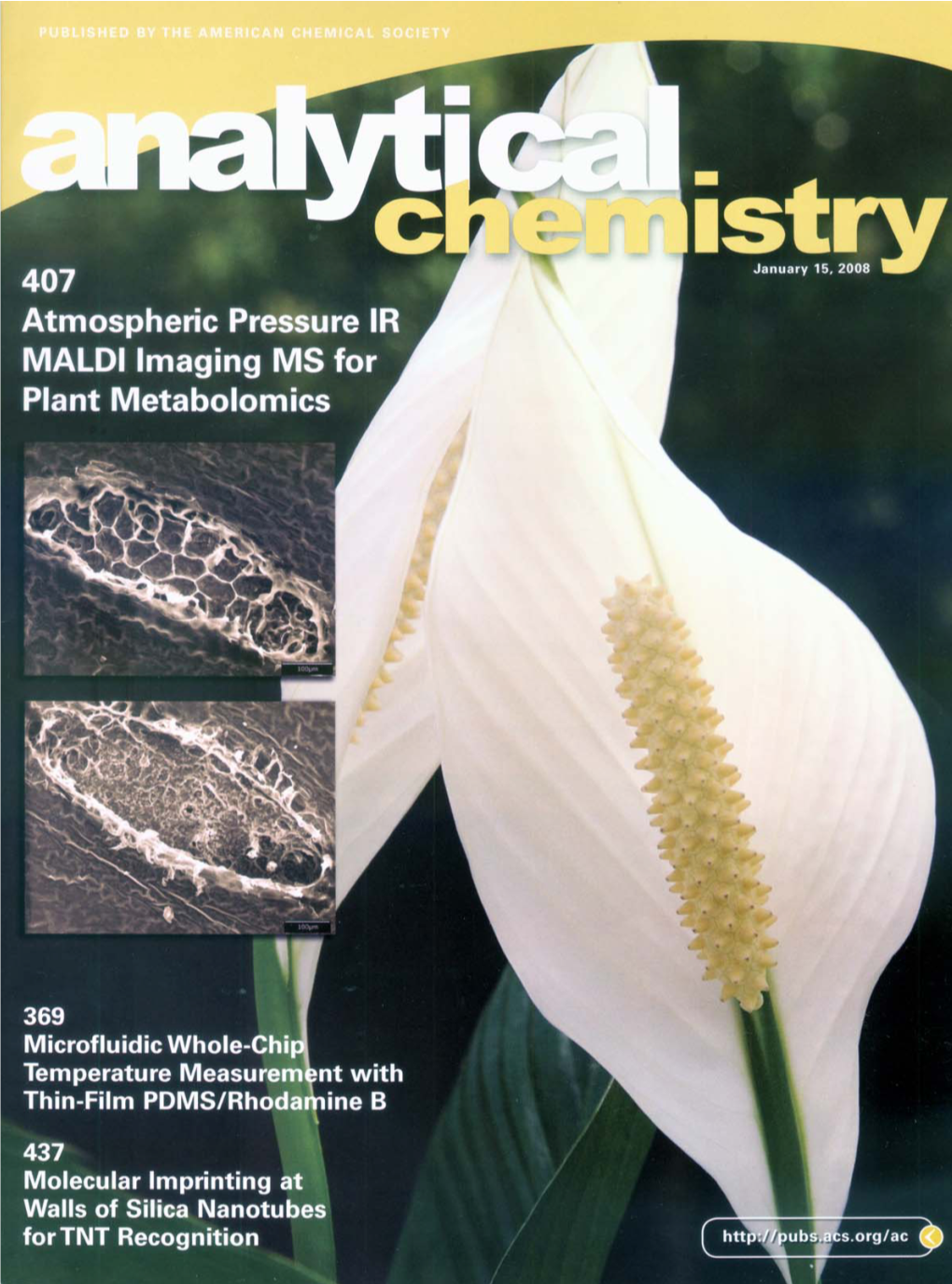 Atmospheric Pressure Infrared MALDI Imaging Mass Spectrometry for Plant Metabolomics