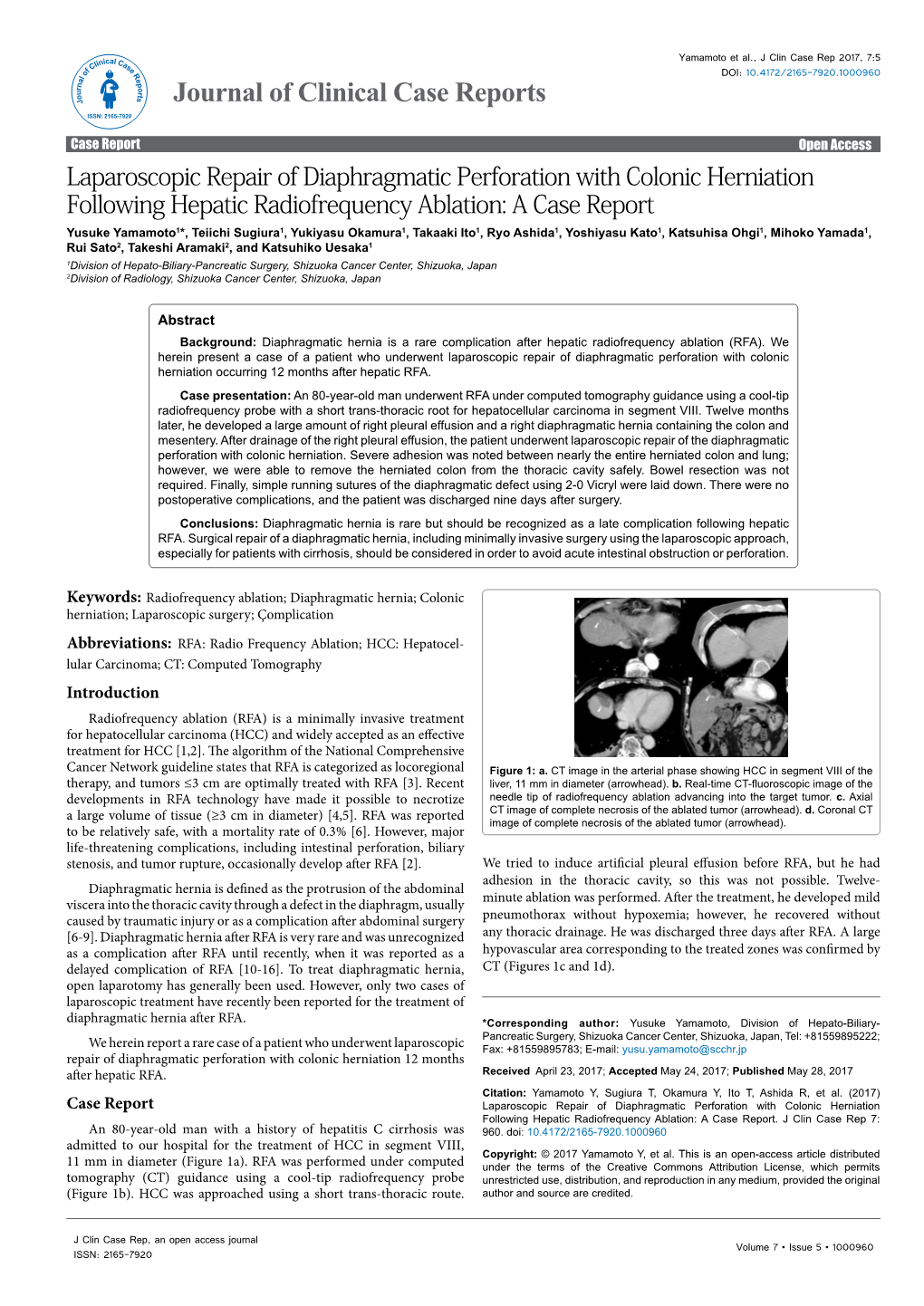 Laparoscopic Repair of Diaphragmatic Perforation With