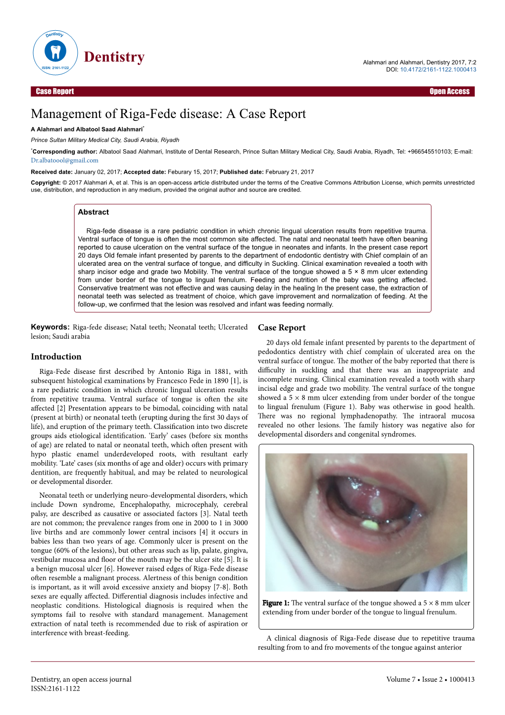 Management of Riga-Fede Disease: a Case Report