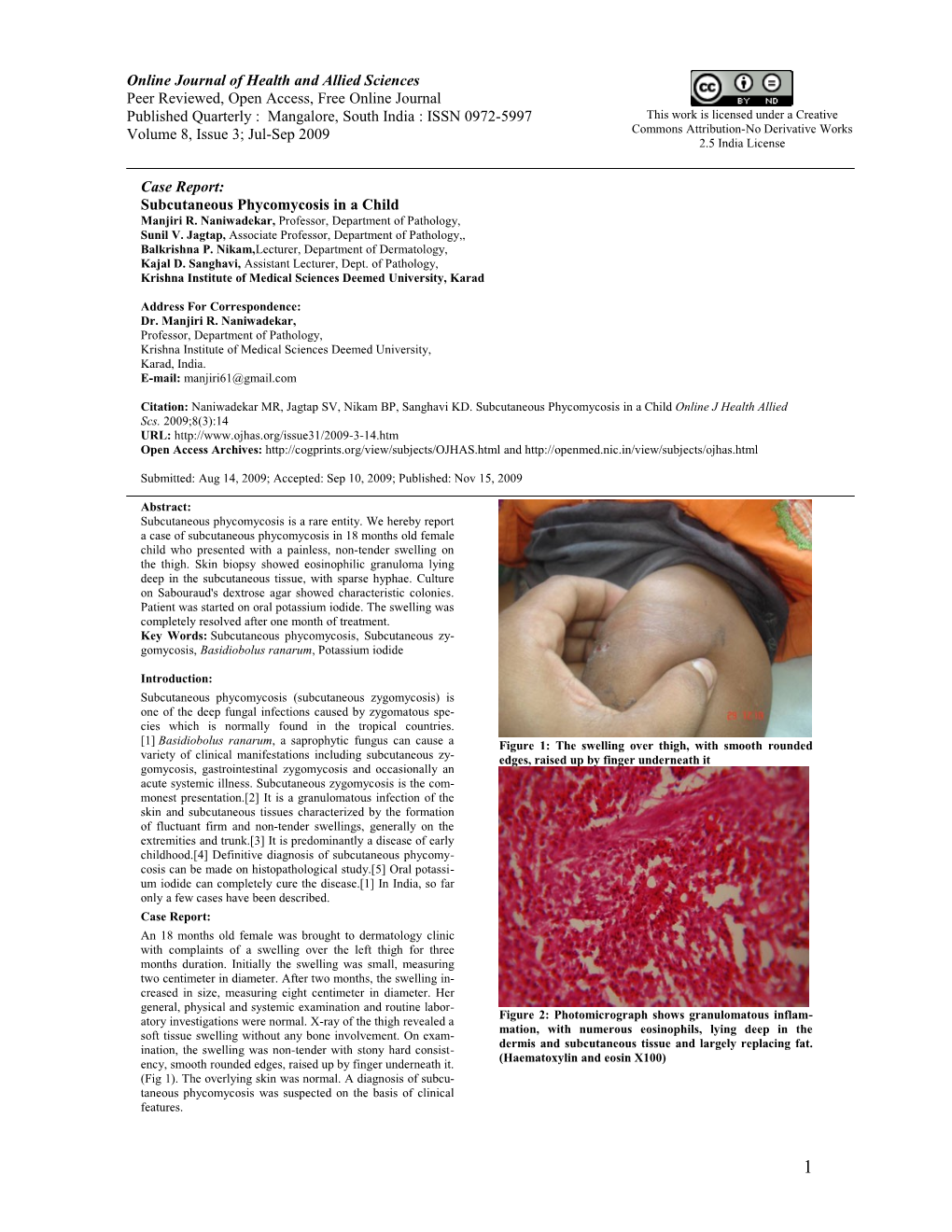 Subcutaneous Phycomycosis in a Child Online Journal Of