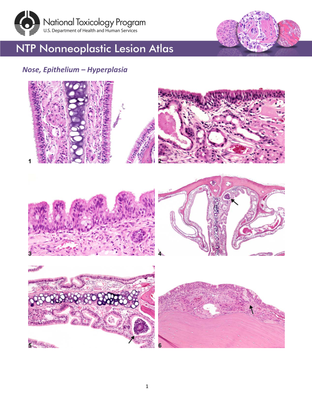 Nose, Epithelium – Hyperplasia