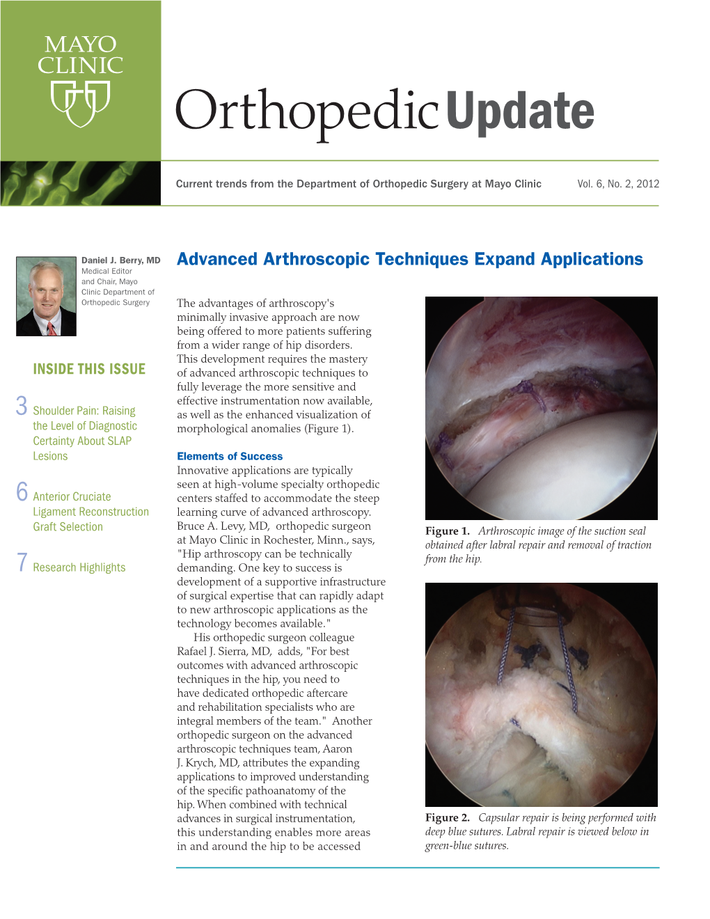 Advanced Arthroscopic Techniques Expand Applications