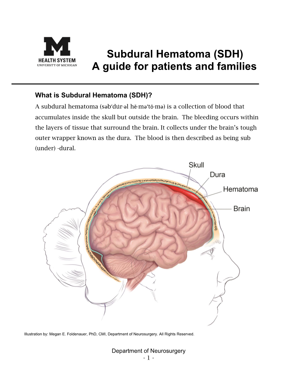 Subdural Hematoma (SDH) a Guide for Patients and Families