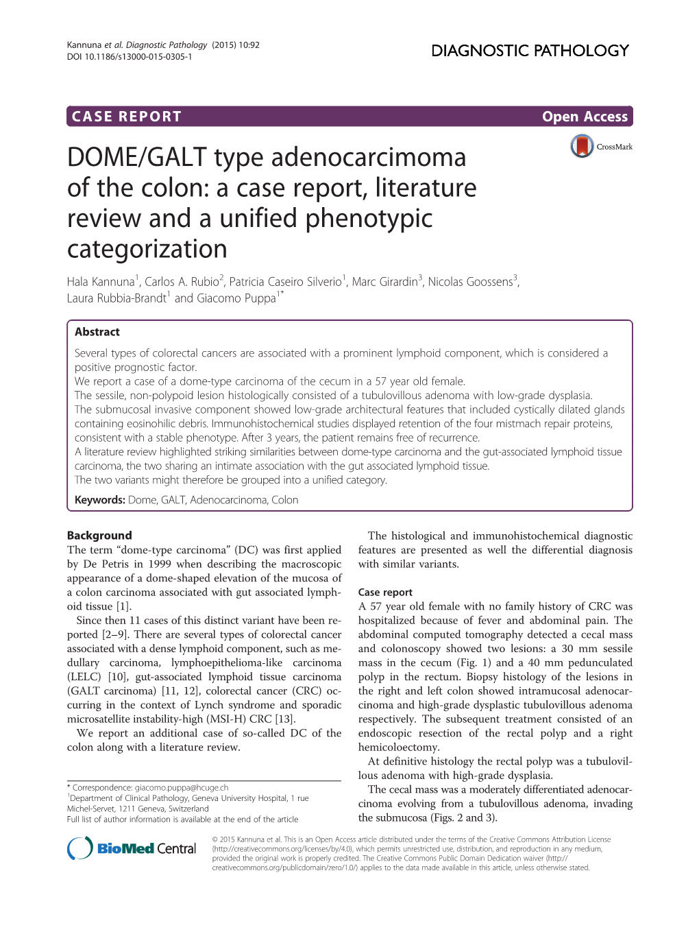 DOME/GALT Type Adenocarcimoma of the Colon: a Case Report, Literature Review and a Unified Phenotypic Categorization Hala Kannuna1, Carlos A