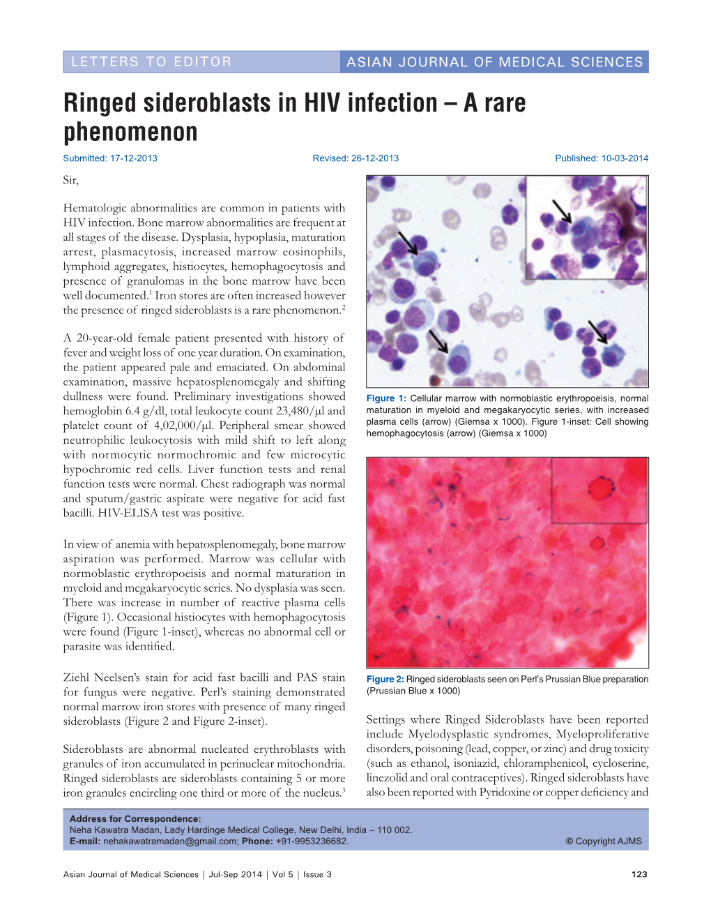 Ringed Sideroblasts in HIV Infection – a Rare Phenomenon Submitted: 17‑12‑2013 Revised: 26‑12‑2013 Published: 10‑03‑2014 Sir