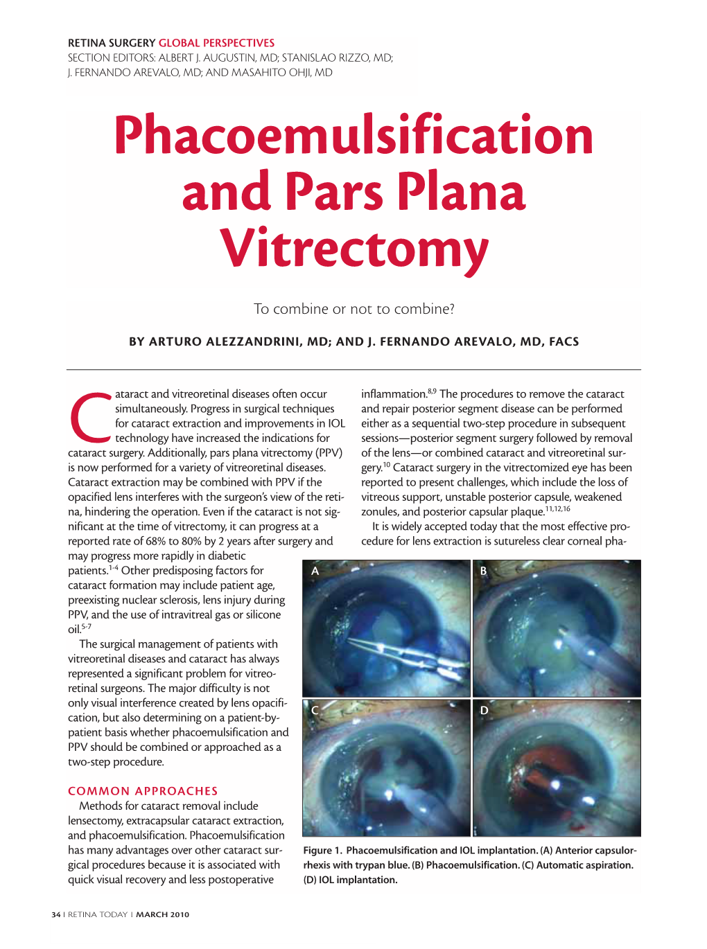 Phacoemulsification and Pars Plana Vitrectomy