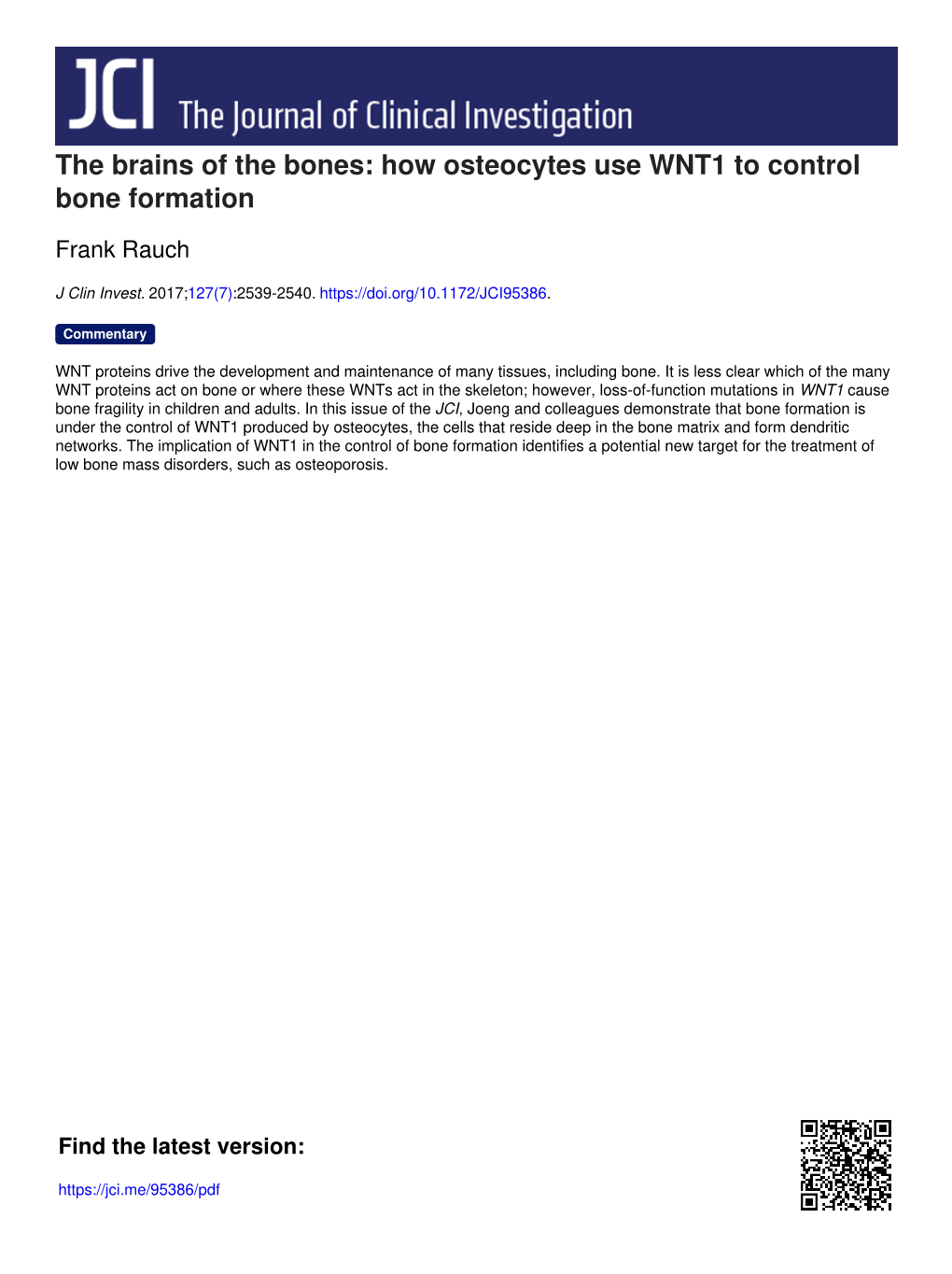 The Brains of the Bones: How Osteocytes Use WNT1 to Control Bone Formation