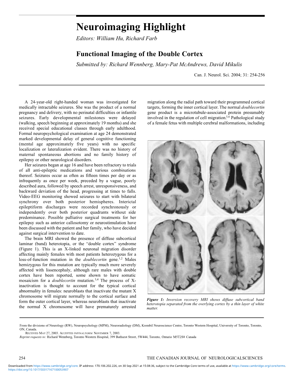 Functional Imaging of the Double Cortex Submitted By: Richard Wennberg, Mary-Pat Mcandrews, David Mikulis