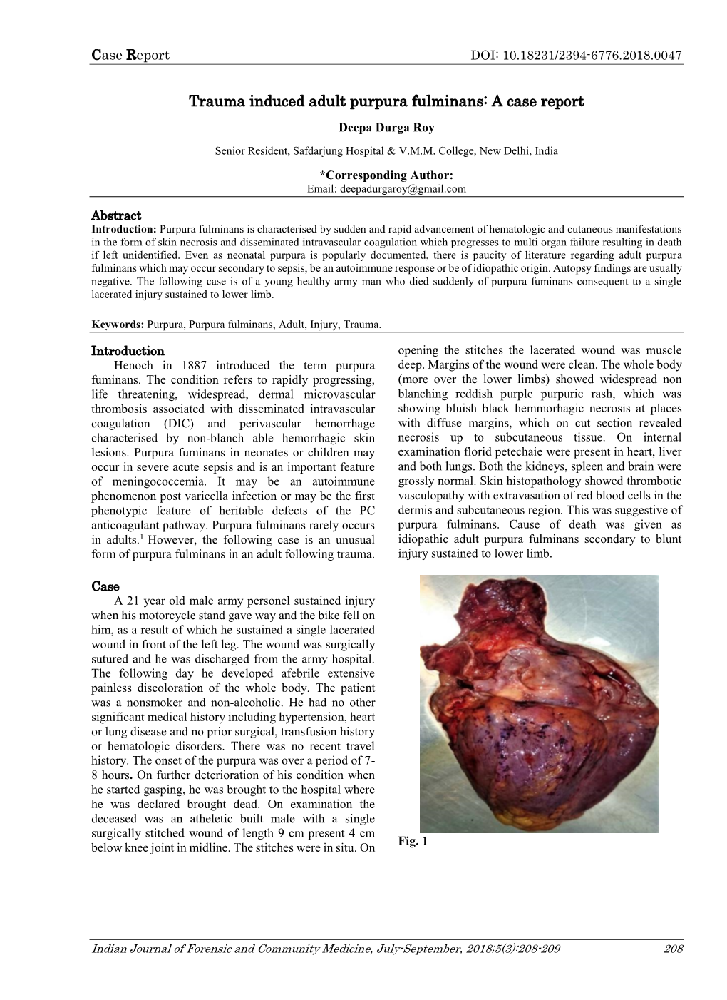 Trauma Induced Adult Purpura Fulminans: a Case Report Deepa Durga Roy Senior Resident, Safdarjung Hospital & V.M.M