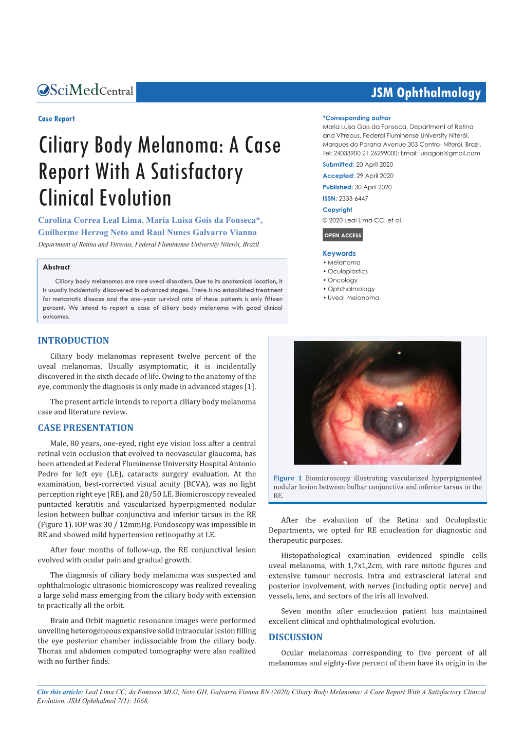 Ciliary Body Melanoma