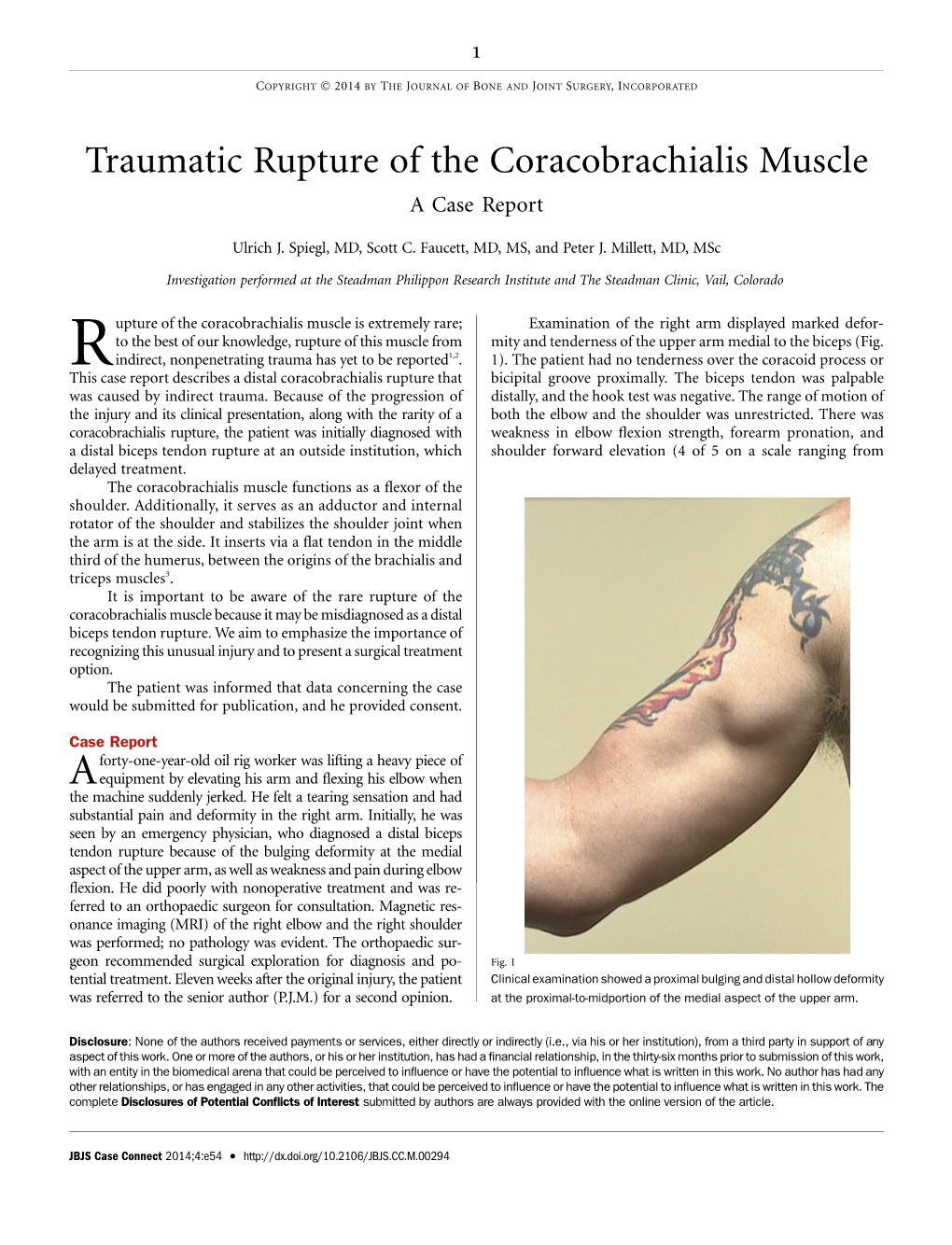 Traumatic Rupture of the Coracobrachialis Muscle Acasereport