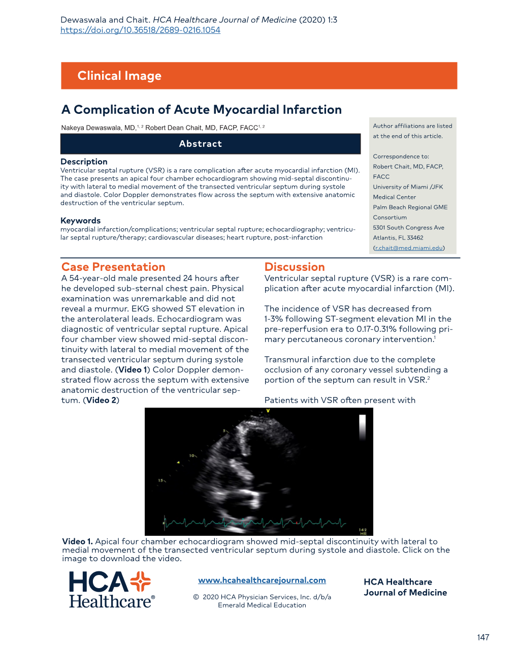 A Complication of Acute Myocardial Infarction