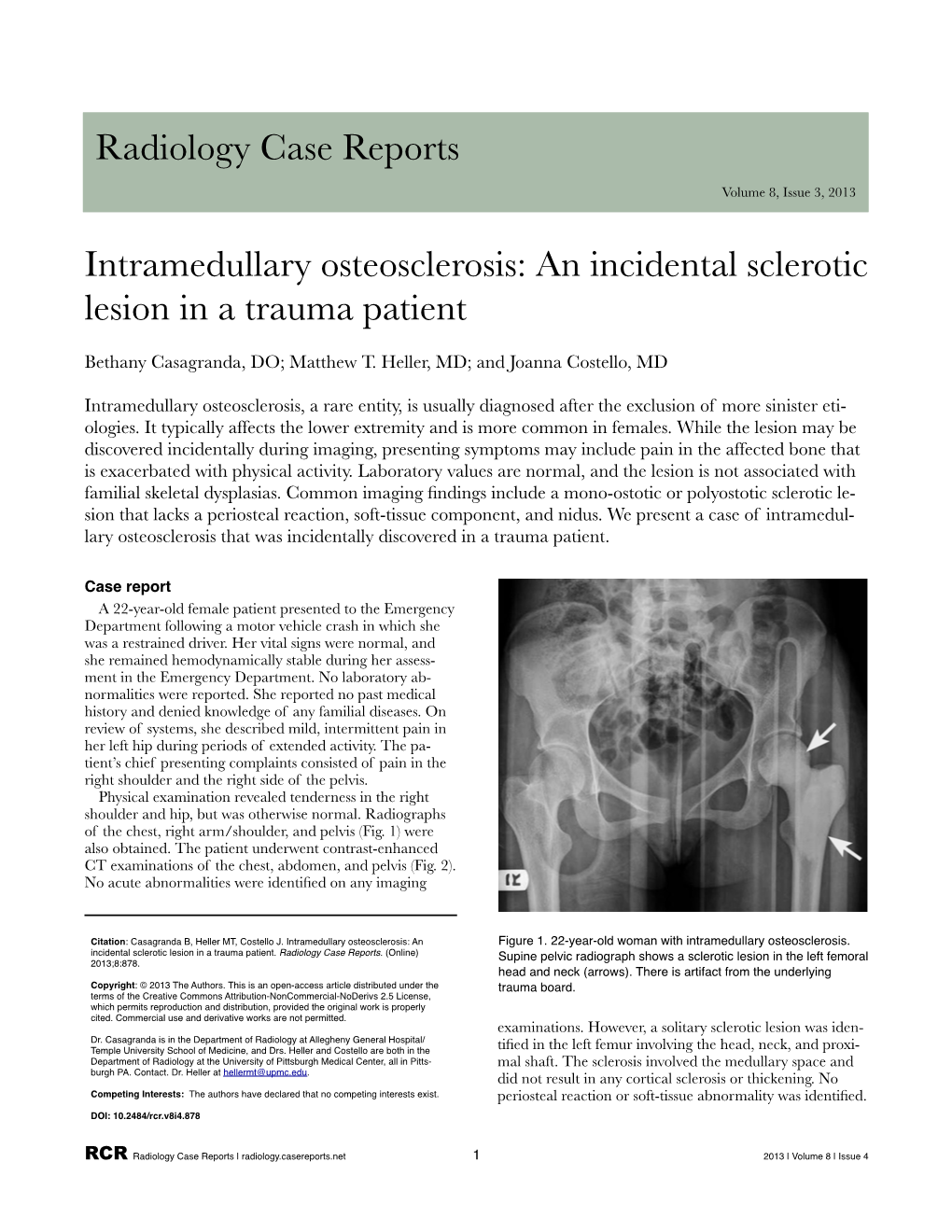 Intramedullary Osteosclerosis: an Incidental Sclerotic Lesion in a Trauma Patient