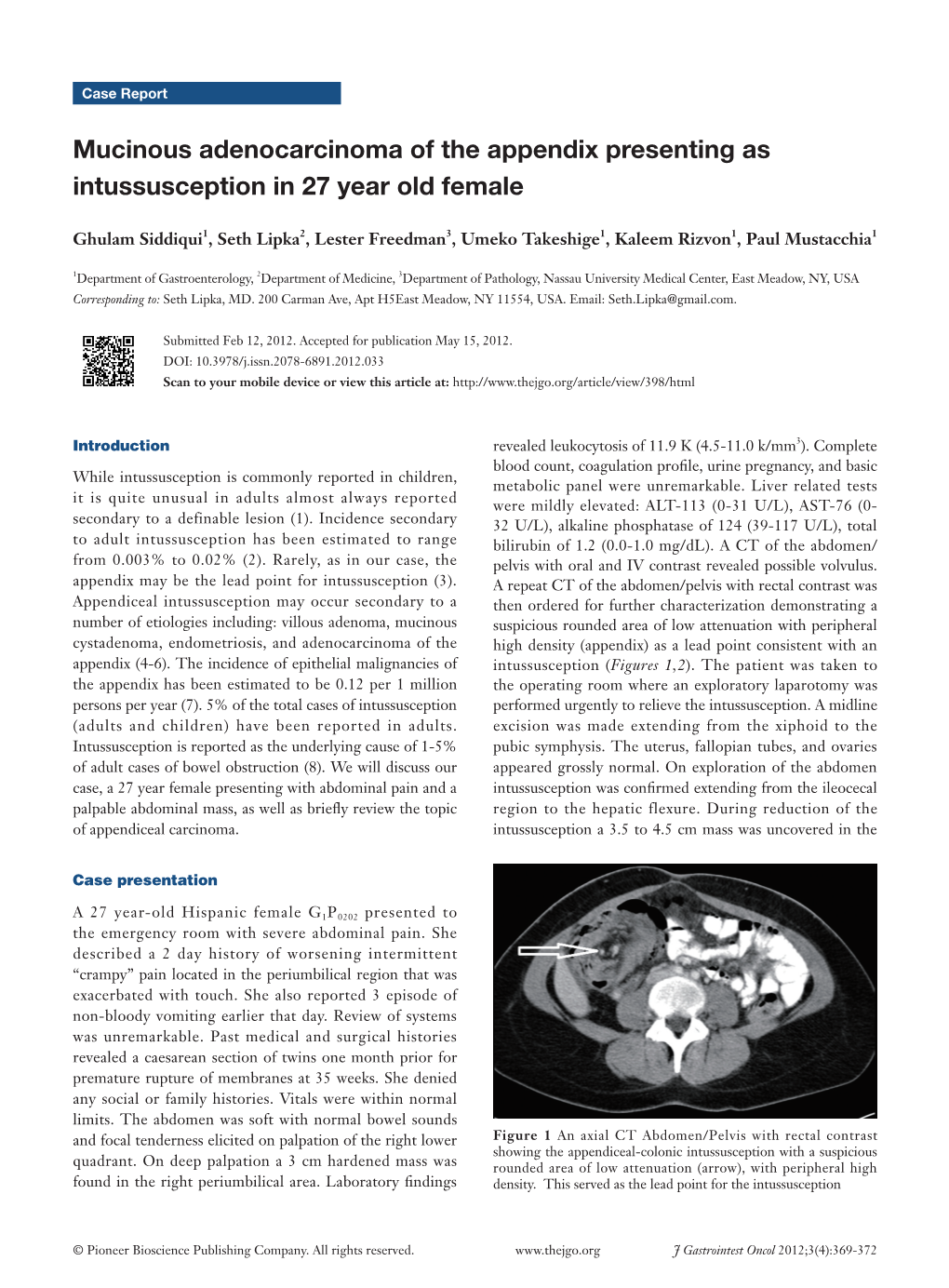 Mucinous Adenocarcinoma of the Appendix Presenting As Intussusception in 27 Year Old Female