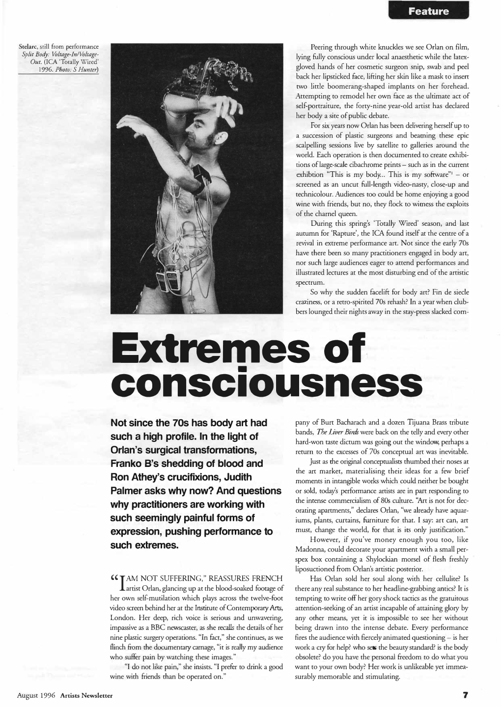 Extremes of Consciousness• Not Since the 70S Has Body Art Had Pany of Burt Bacharach and a Dozen Tijuana Brass Tribute Such a High Profile