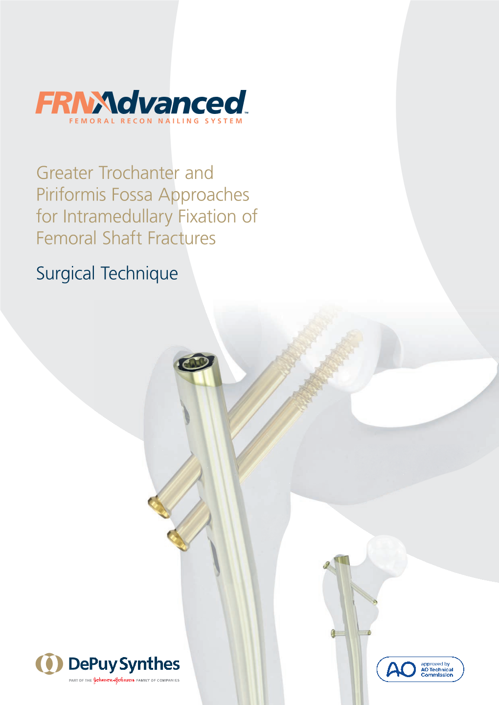 Greater Trochanter and Piriformis Fossa Approaches for Intramedullary Fixation of Femoral Shaft Fractures Surgical Technique Image Intensiﬁer Control