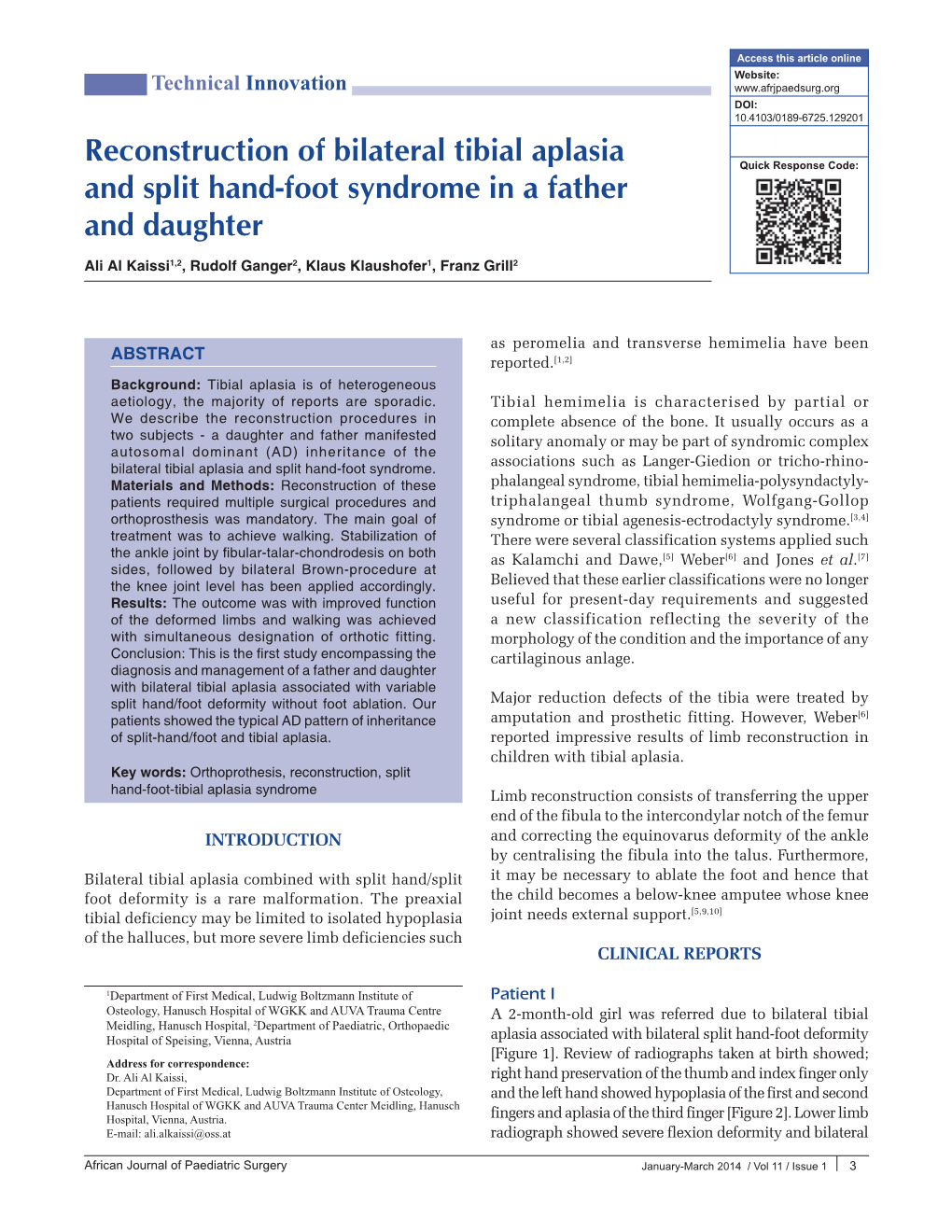 Reconstruction of Bilateral Tibial Aplasia and Split Hand-Foot Syndrome in a Father and Daughter