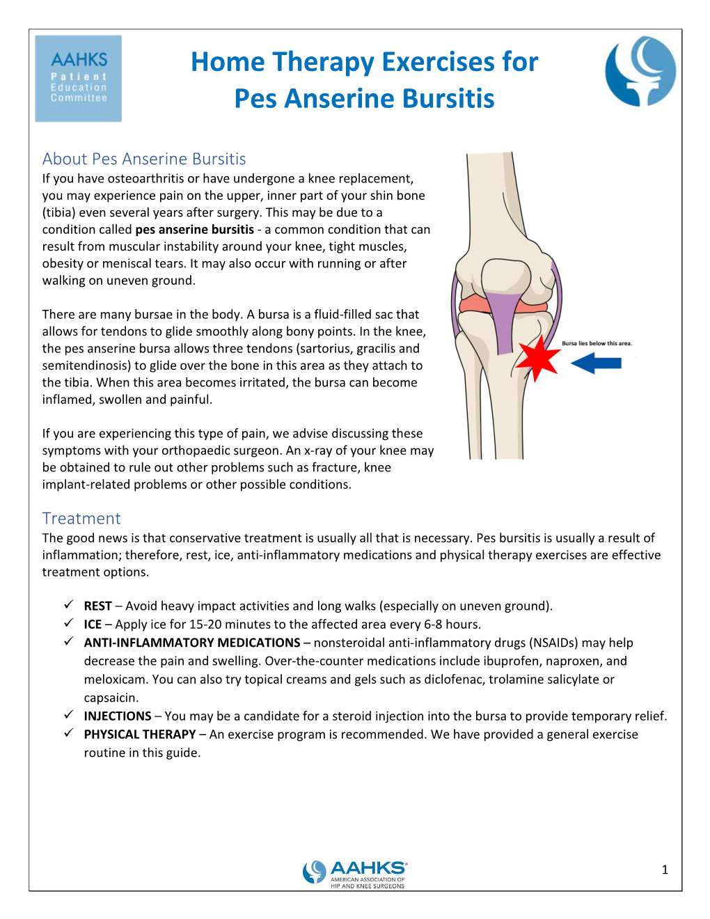 Pes Anserine Bursitis in the Knee