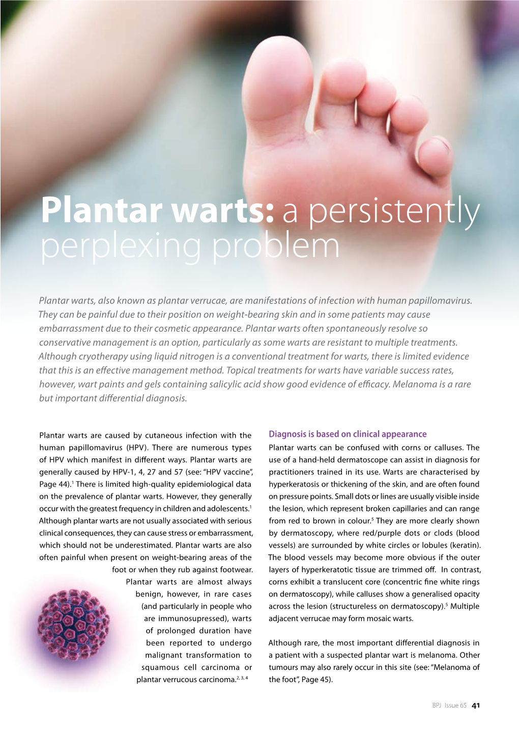 Plantar Warts: a Persistently Perplexing Problem