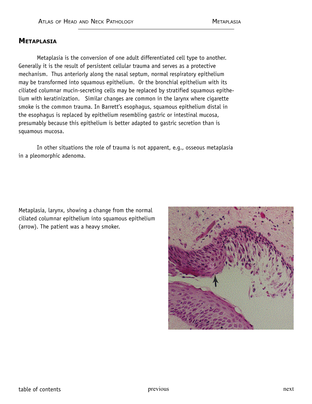 Table of Contents Previous Next Metaplasia Is the Conversion of One