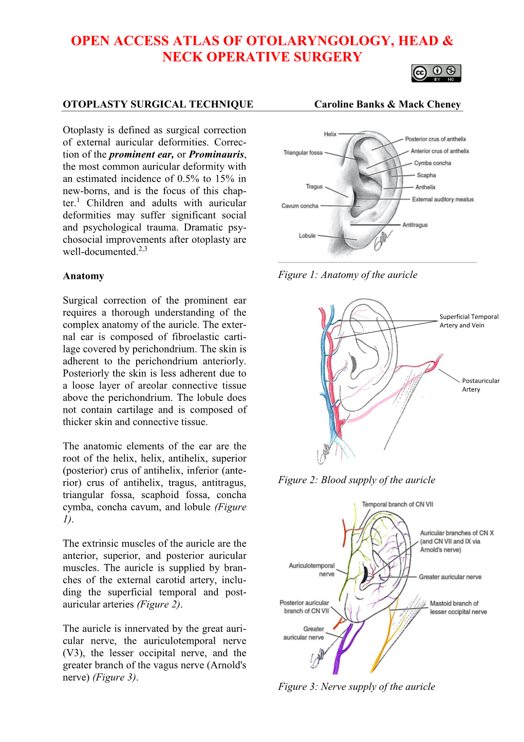 OTOPLASTY SURGICAL TECHNIQUE Caroline Banks & Mack Cheney