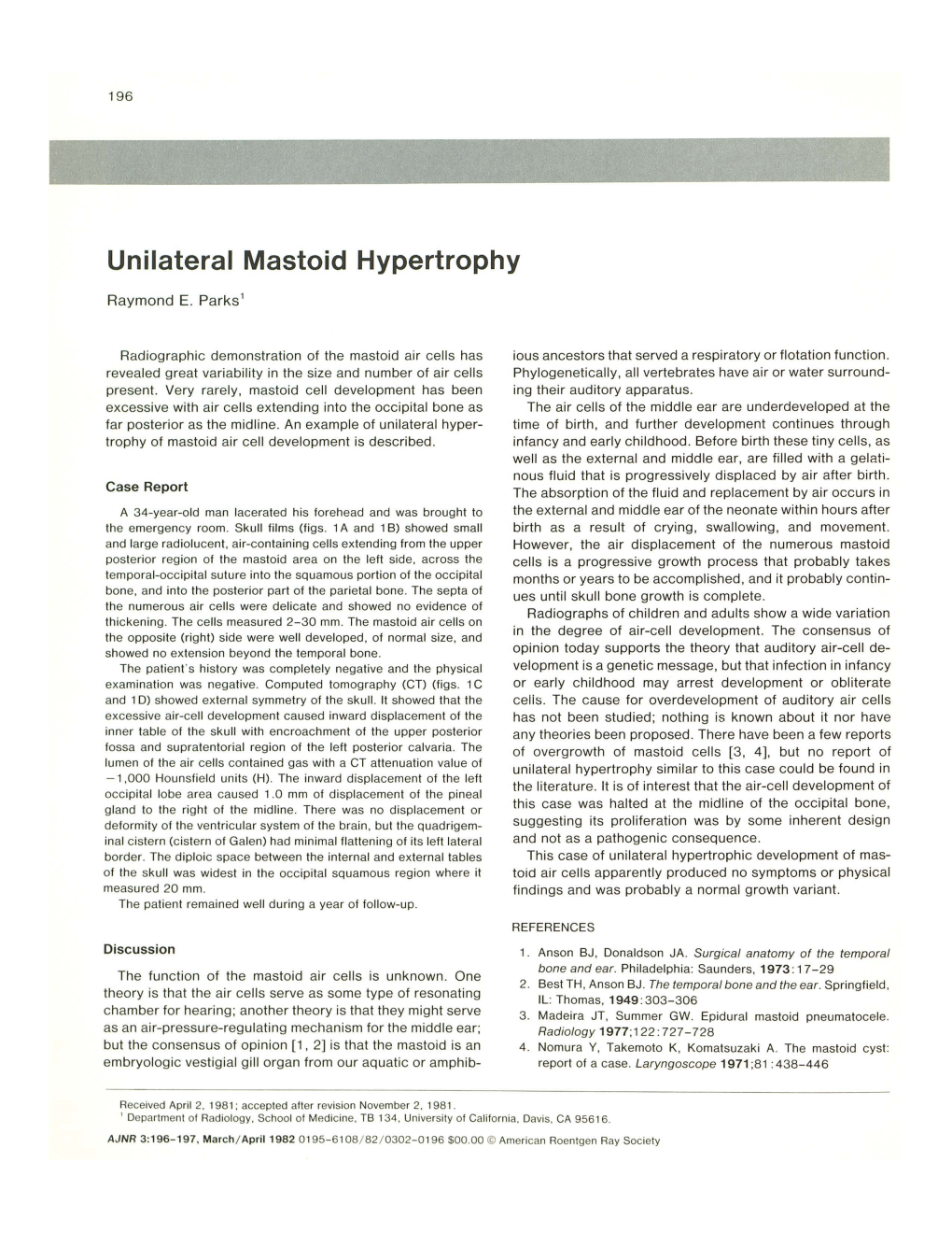 Unilateral Mastoid Hypertrophy