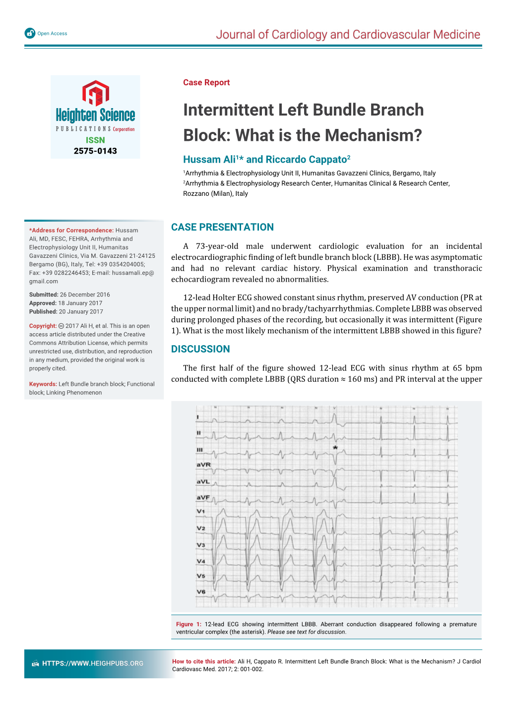 Intermittent Left Bundle Branch Block: What Is the Mechanism? J Cardiol Cardiovasc Med