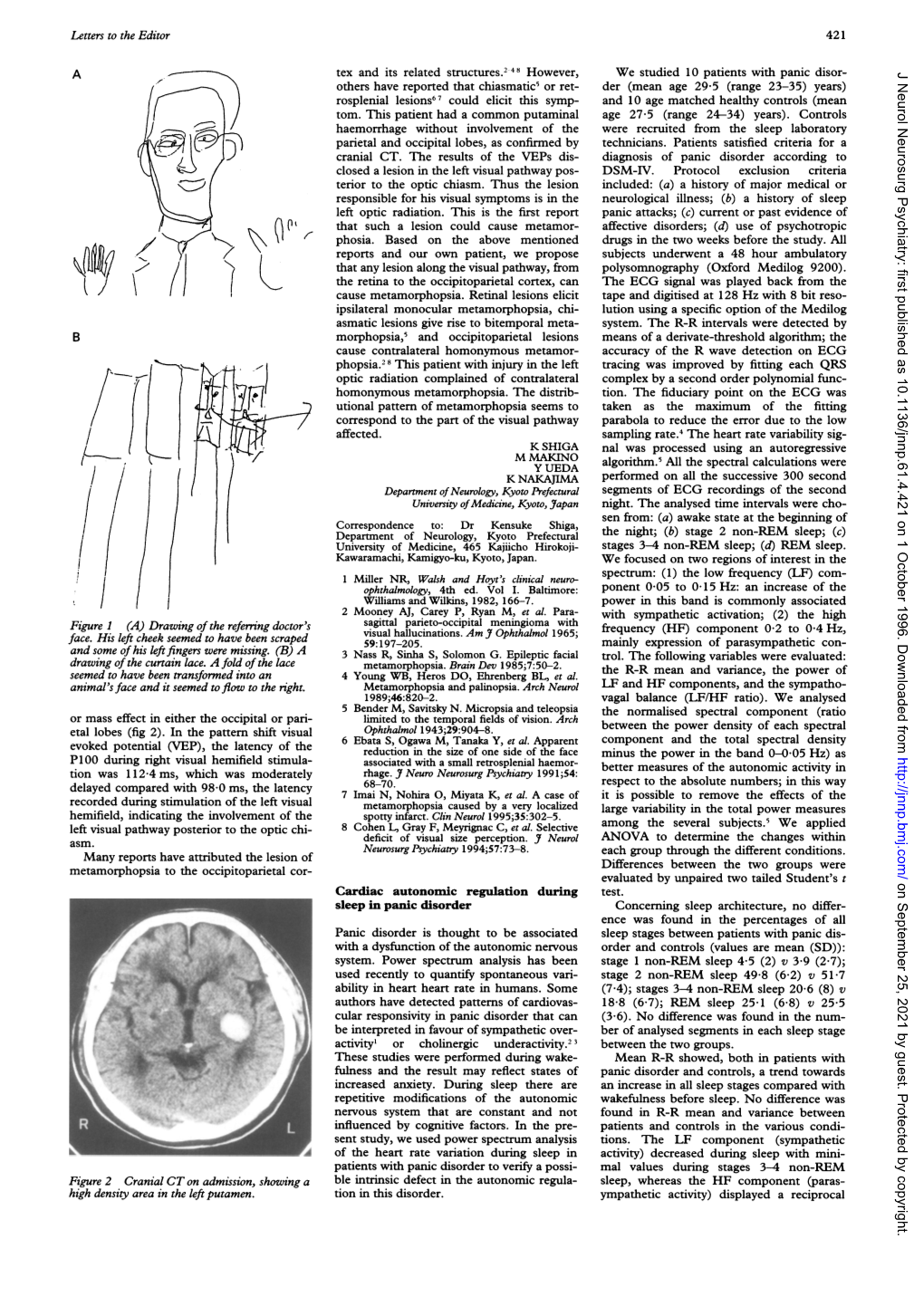 Morphopsia,' and Occipitoparietal Lesions Homonymous Metamorphopsia. the Distrib- Activity' Or Cholinergic Underactivity.23 Main