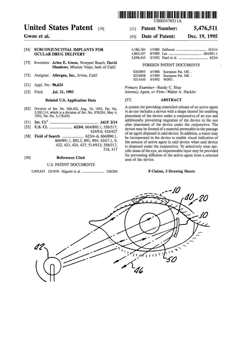 US5476511.Pdf