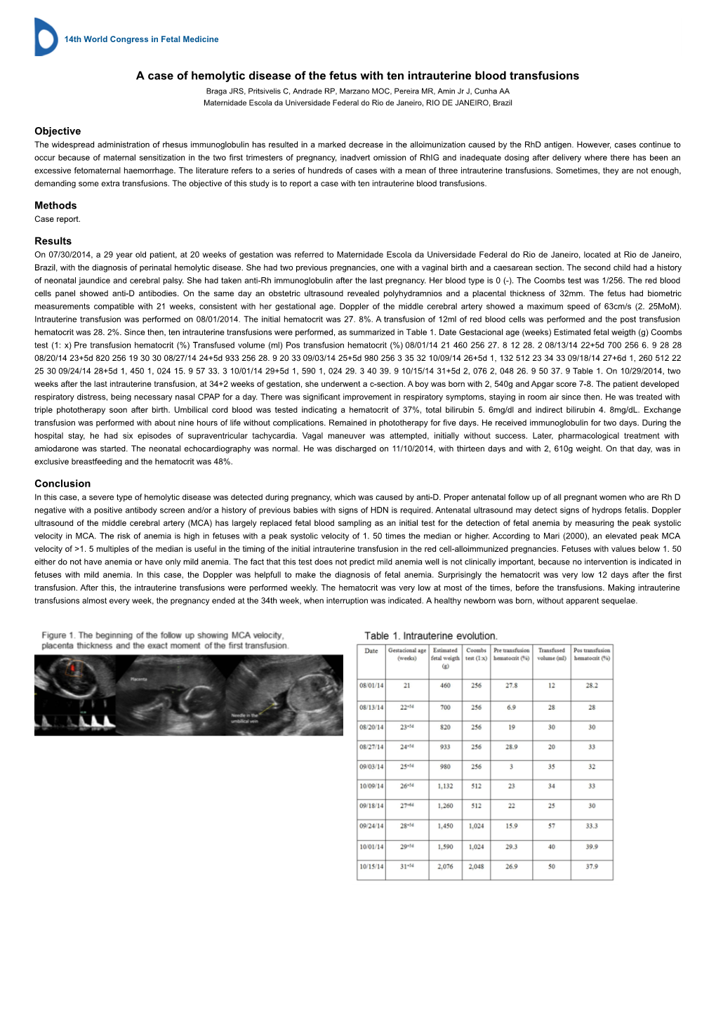 A Case of Hemolytic Disease of the Fetus with Ten Intrauterine Blood