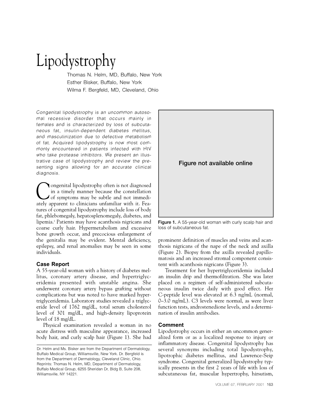 Lipodystrophy Thomas N