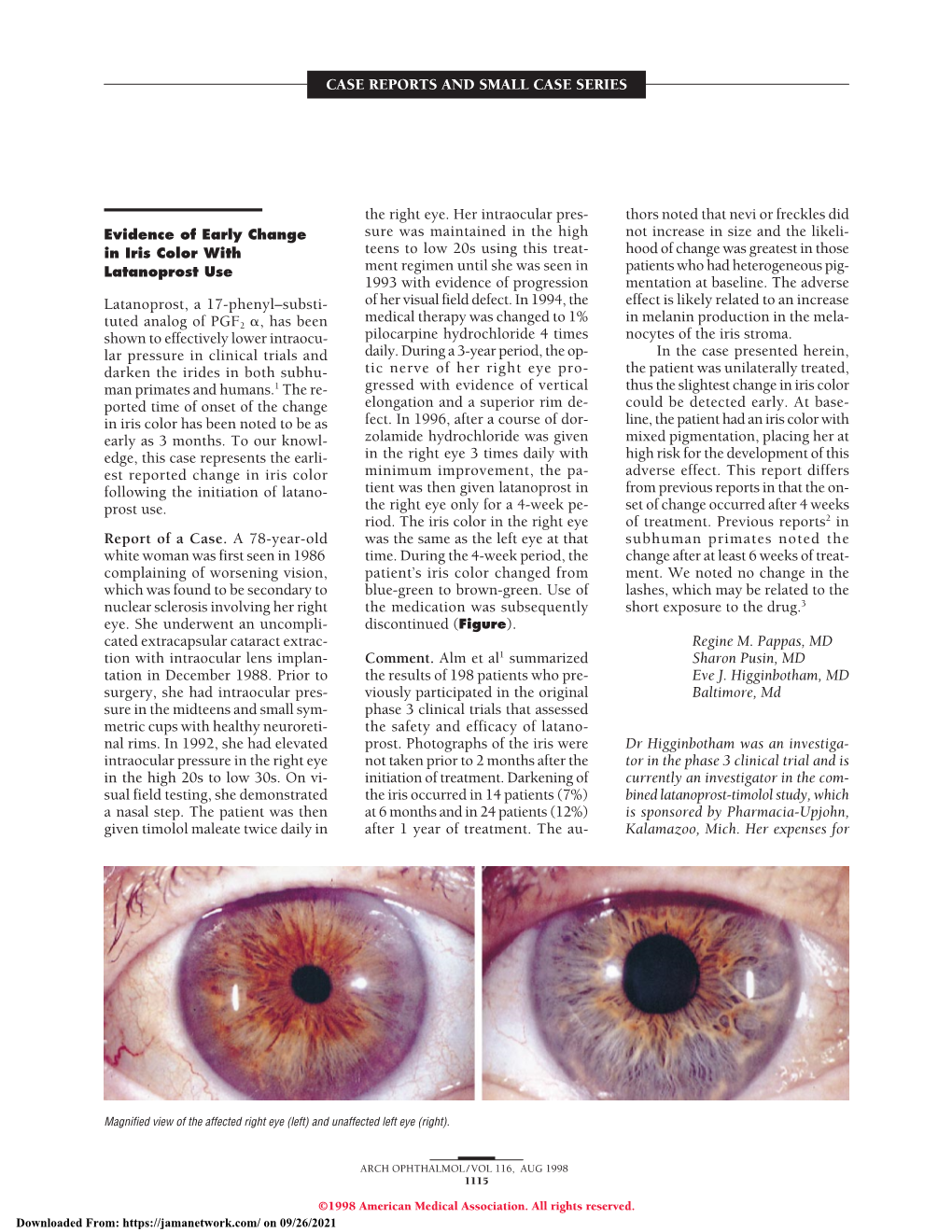 Autoimmune Optic Neuropathy Ac- Tic Nerve Tissue Affected by Autoim- Tic Neuropathy: Evaluation and Treatment