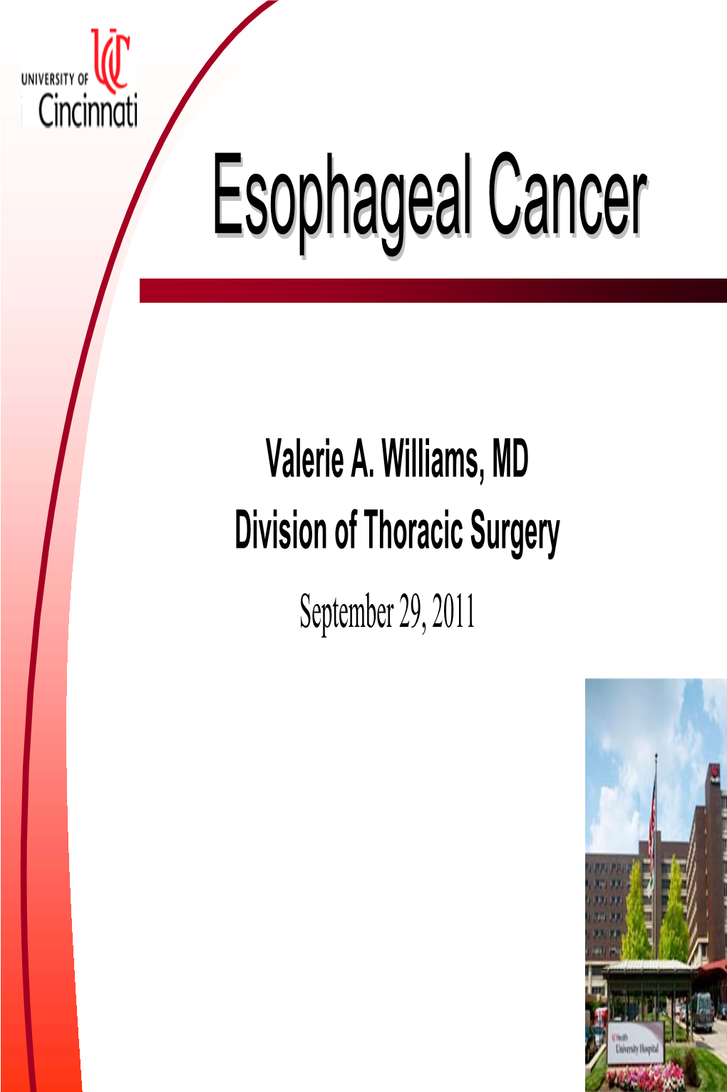 Esophagectomy in the Treatment of Esophageal Cancer