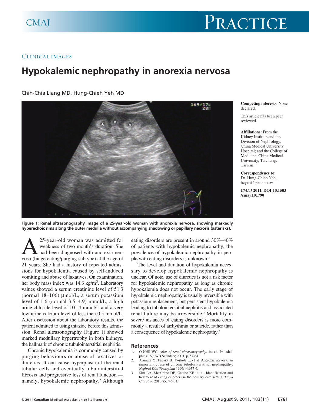Hypokalemic Nephropathy in Anorexia Nervosa