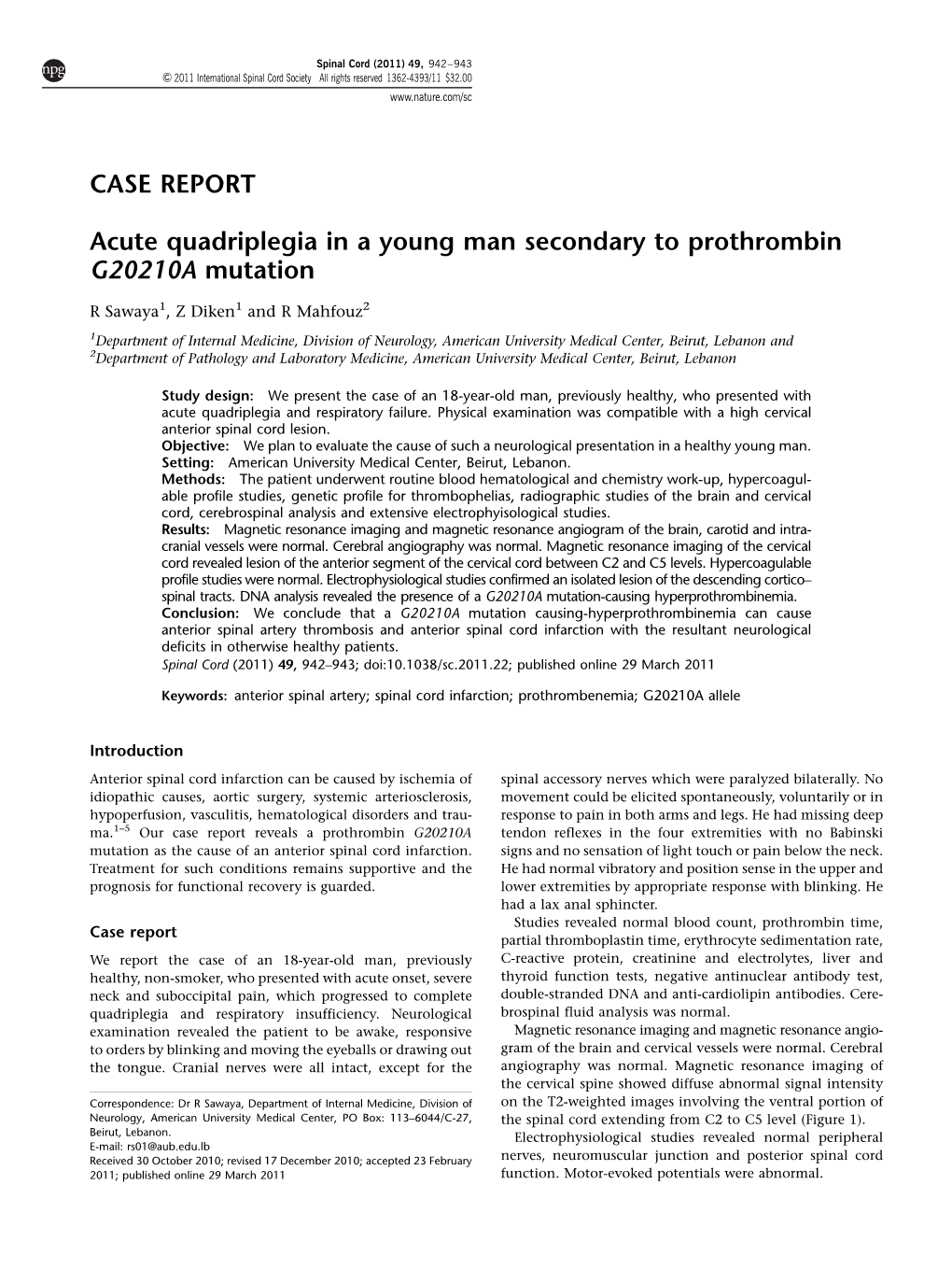 Acute Quadriplegia in a Young Man Secondary to Prothrombin G20210A Mutation