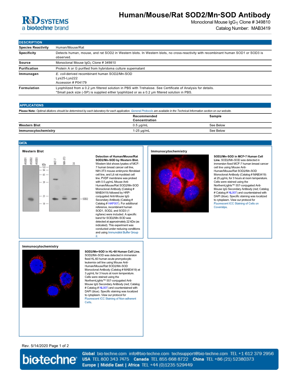 Human/Mouse/Rat SOD2/Mn‑SOD Antibody