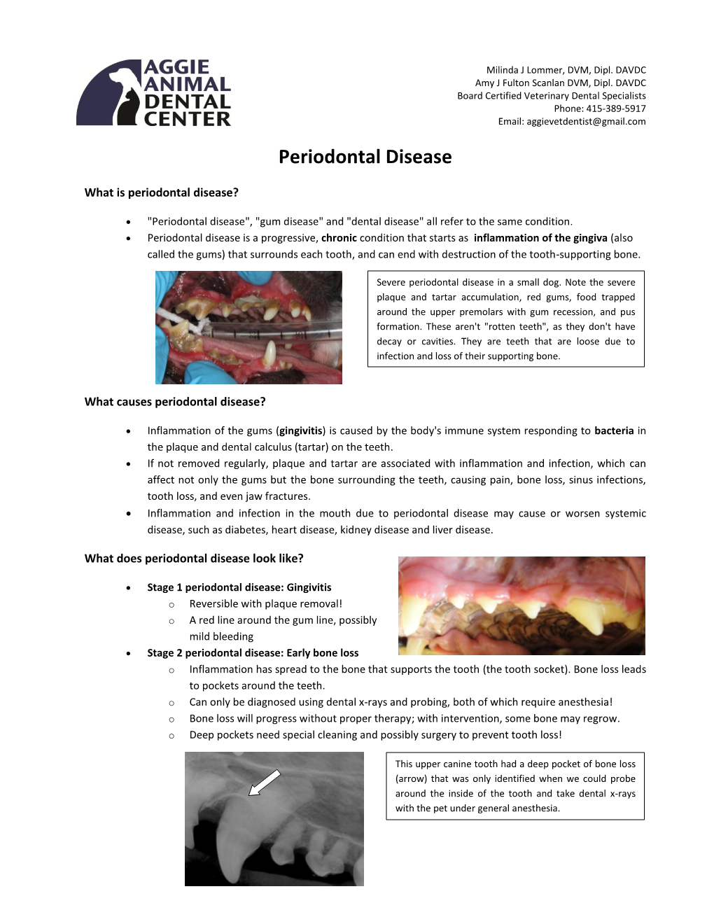 Periodontal Disease